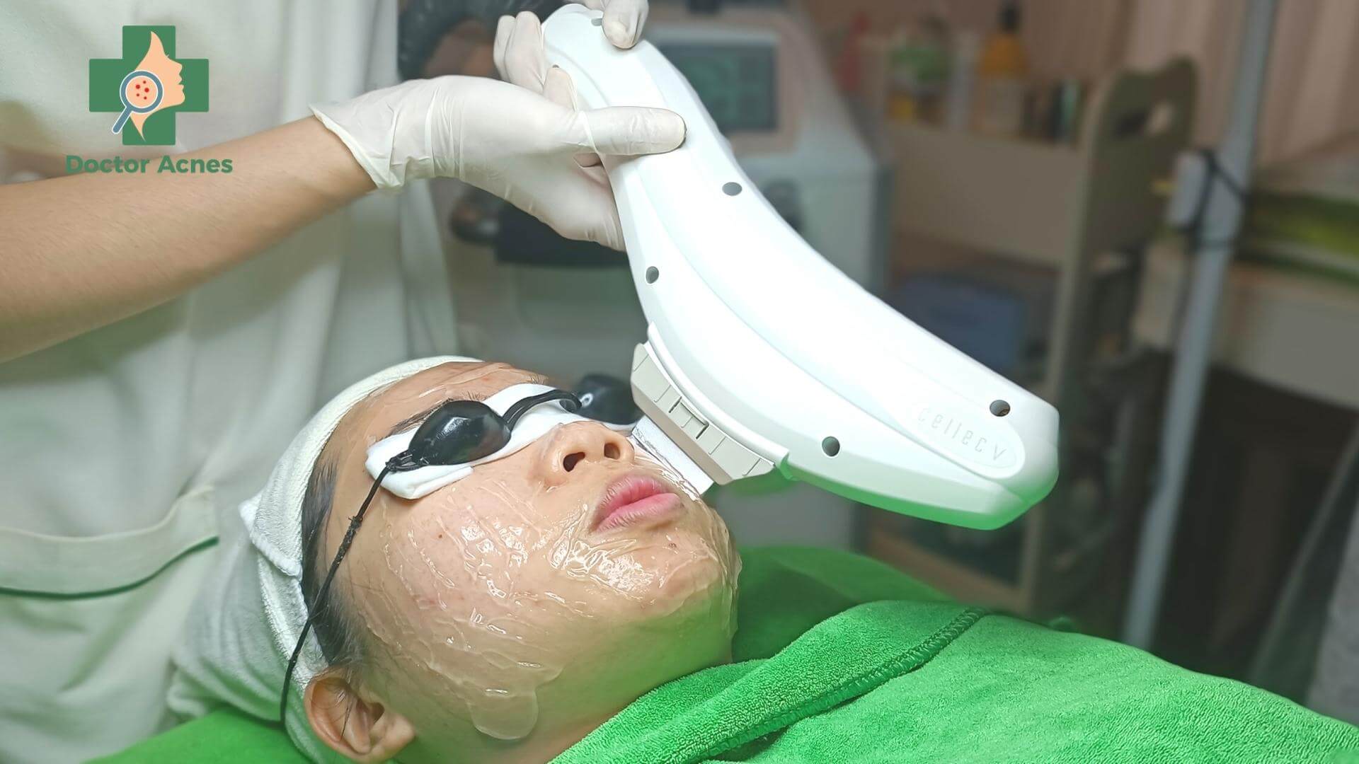 IPL là gì - Doctor Acnes